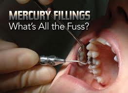 mercury fillings